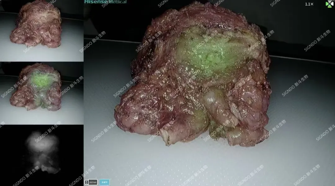 WechatIMG536 WechatIMG536